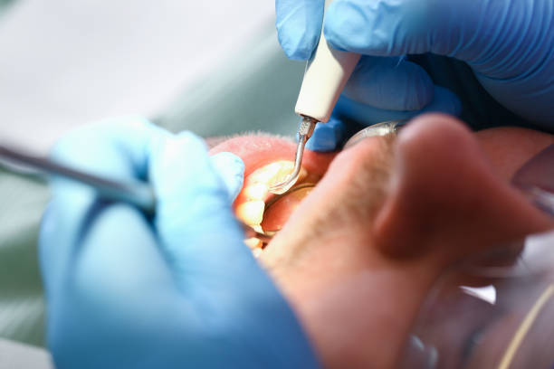 Best 24-Hour Emergency Dental Care in Wild Peach Village, TX