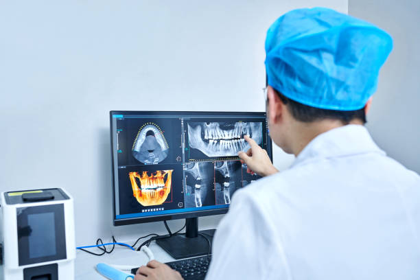 Best Broken or Chipped Tooth Repair in Wild Peach Village, TX